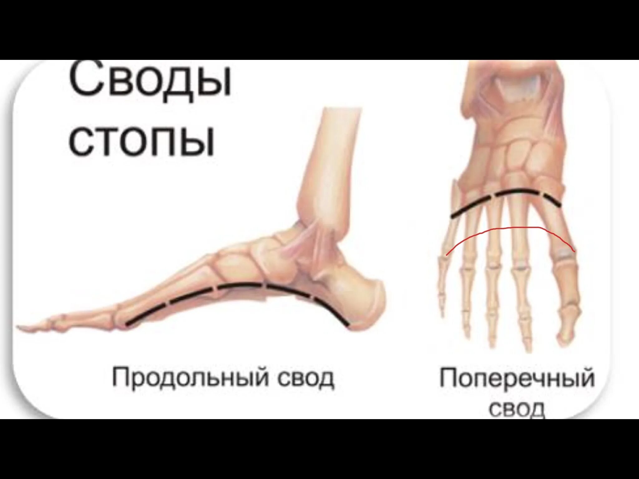 Продольный свод стопы анатомия. Продольный и поперечный свод стопы. Продольный и поперечный свод стопы функции. Поперечный свод стопы анатомия. Продольный поперечный свод