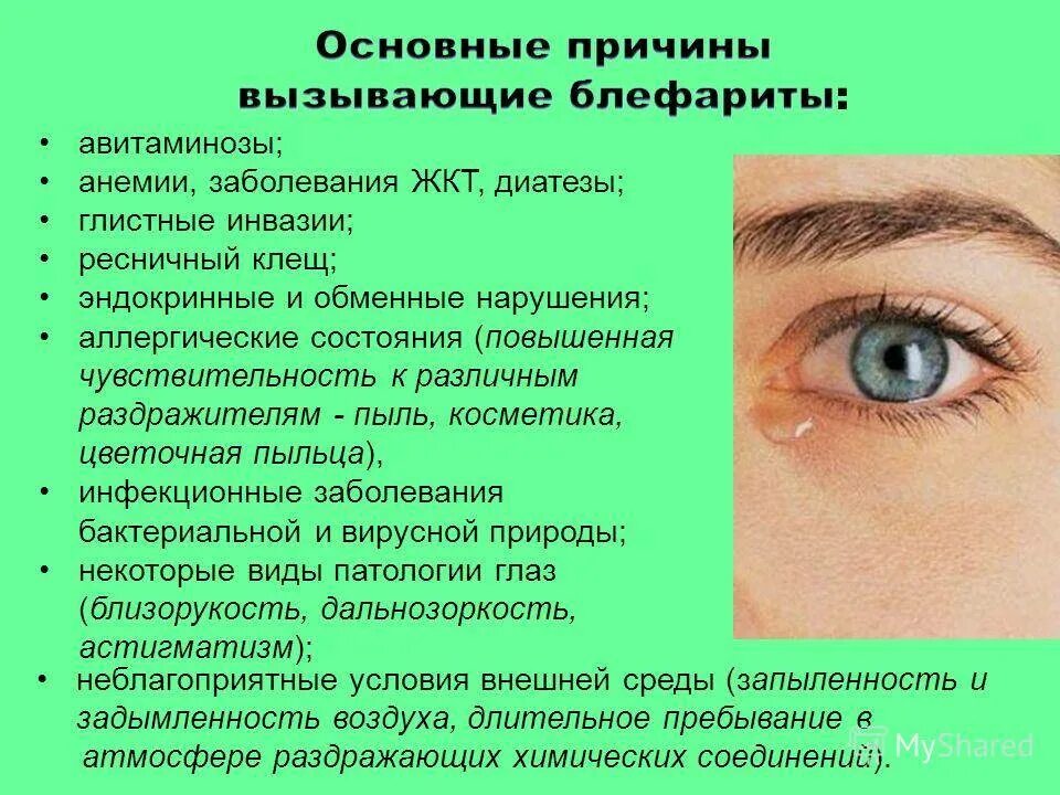С какими болезнями находятся. Блефарит причины возникновения. Заболевание глаз блефарит.