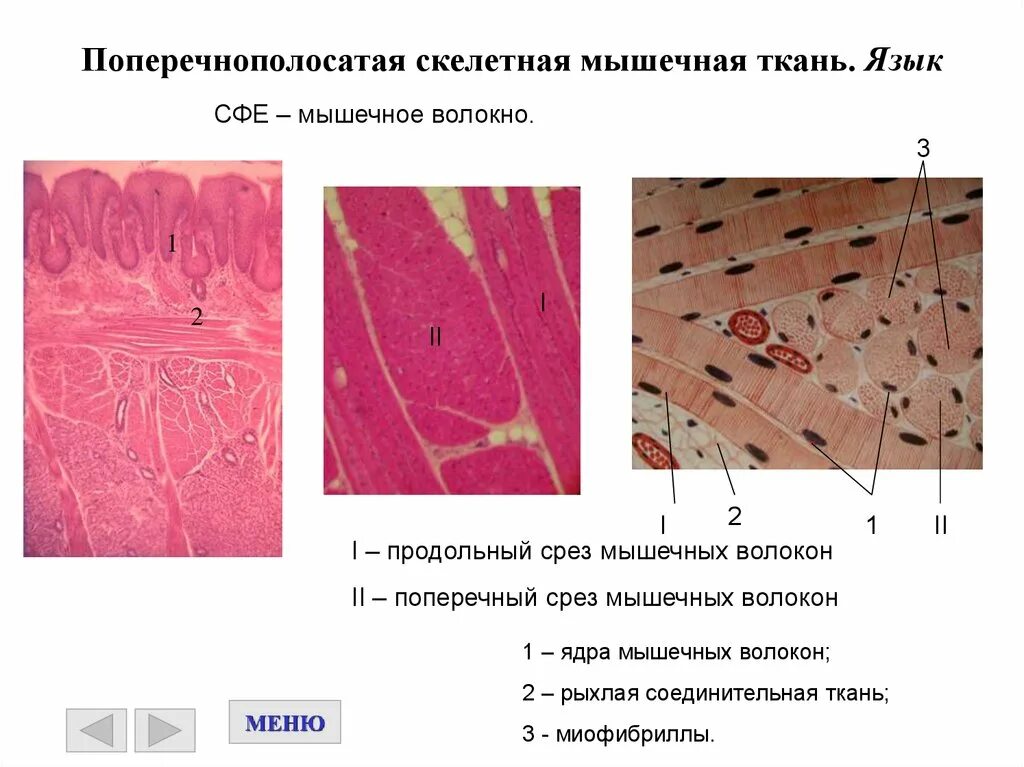 Поперечнополосатая скелетная мышечная ткань особенности строения. Поперечно полосатая Скелетная ткань гистология. Продольный срез поперечно полосатой мышечной ткани. Мышечная ткань языка гистология. Поперечнополосатая Скелетная мышечная ткань языка препарат.