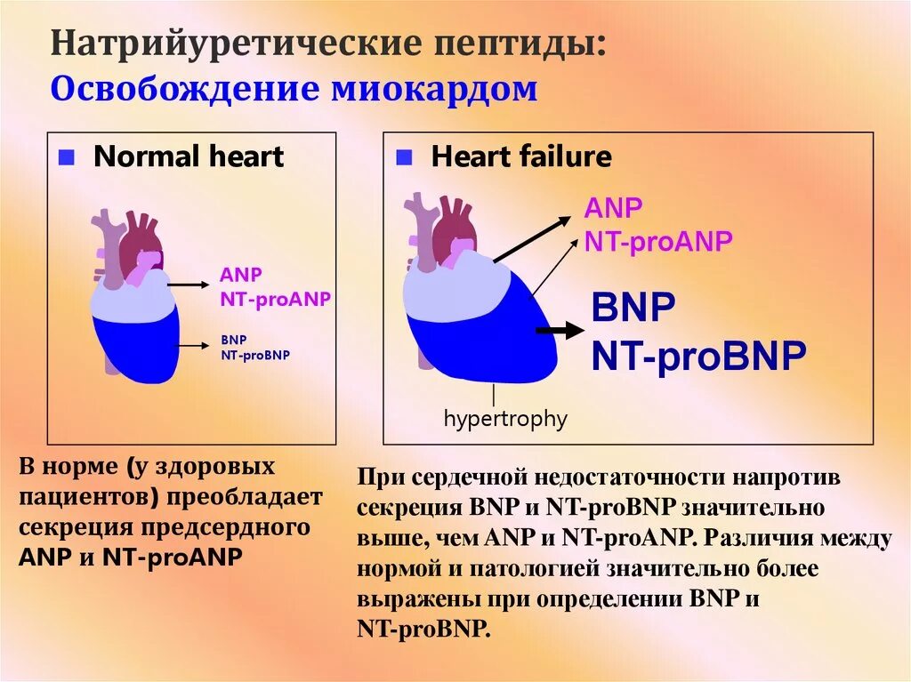 Белок сердечной недостаточности. Мозговой натрийуретический пептид (NT-PROBNP) норма. NT Pro BNP натрийуретический пептид. Мозговой натрийуретический пептид при сердечной недостаточности. Уровень натрийуретического пептида при ХСН.