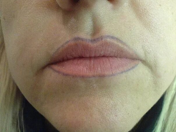 Плохие губы. Неудачный перманентный ма3ияж шуб. Татуаж губ. Контур губ. Неудачный перманентный макияж губ.
