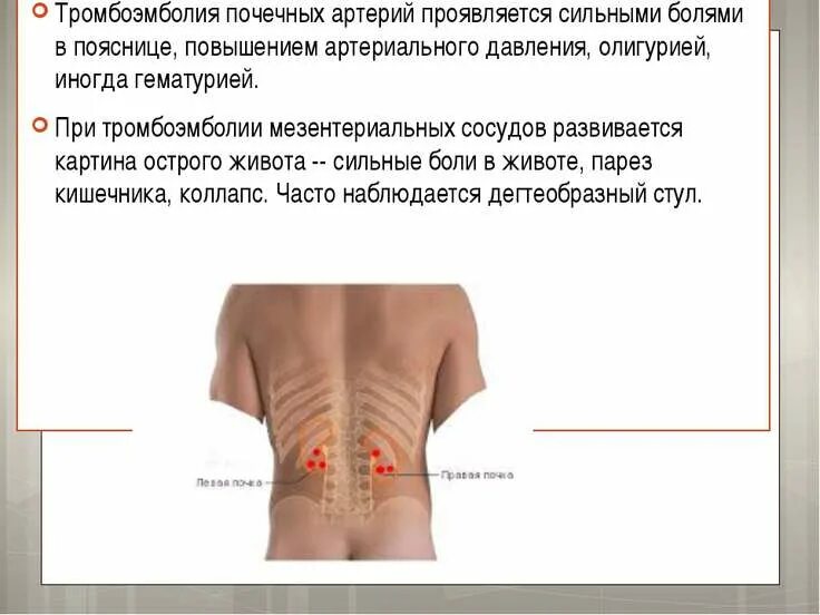 Болит левый бок поясница причина. Болит поясница слева снизу. боль справа от поясницы сзади. сзади слева на пояснице боль.