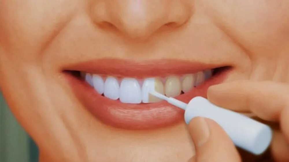 Зуб отбеливание пить. Краска для зубов. Отбеливание зубной эмали. Краска для зубов белая.