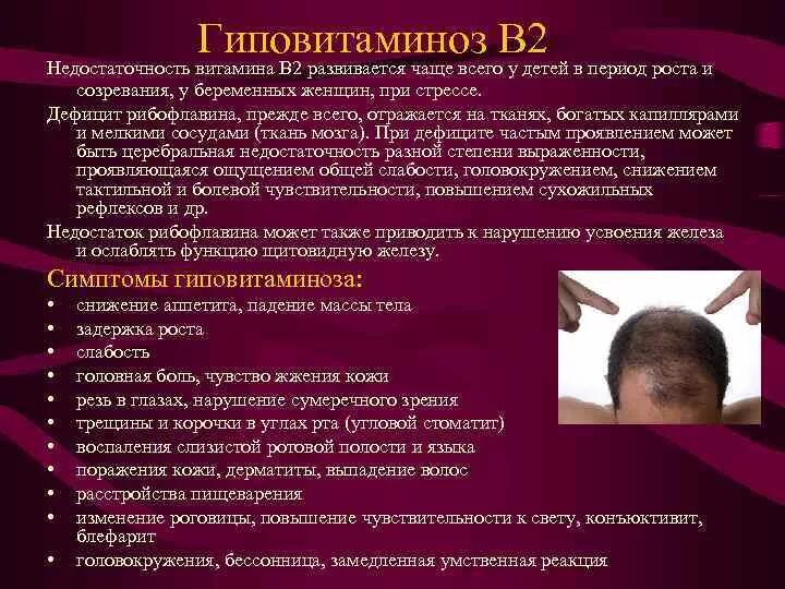 Недостаток б6. Гиповитаминоз витамина в2. Признаки гиповитаминоза витамина в2. Дефицит витамина b2 (рибофлавина).