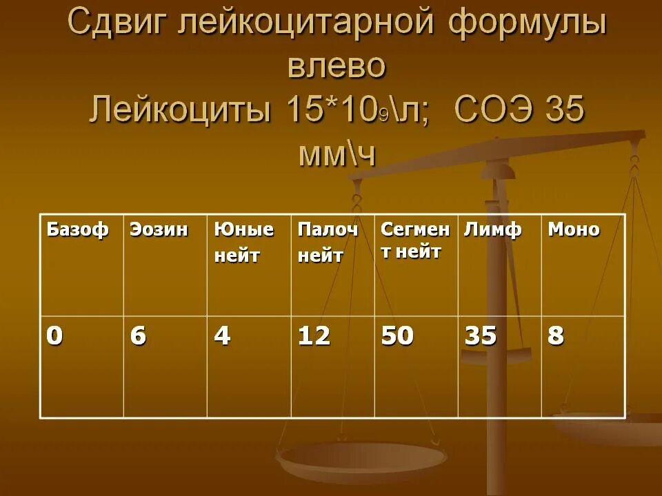 Вид деформации сдвиг. Сдвиг рисунок. Сдвиг фото. Сдвиг фото. Смещение горных пород.