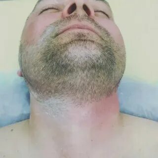 Борода мужская депиляция
