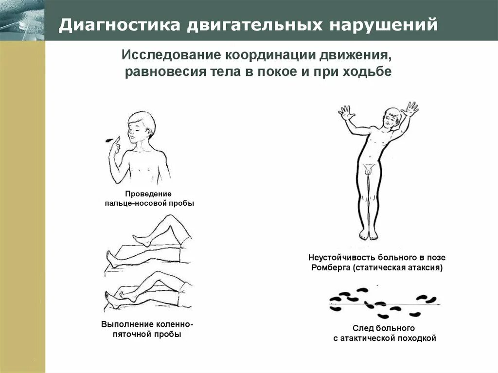 Нарушение организации движений. Методы определения двигательных нарушений. Методы исследования координации движений. Двигательные неврологические нарушения. Методика исследования координации движений.