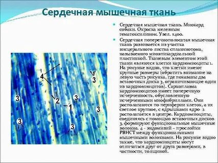 Сердечная ткань какая