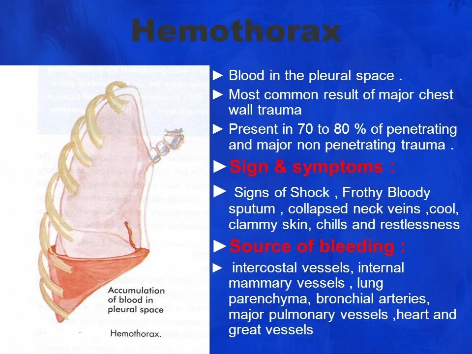 Hemothorax. Гемоторакс презентация. Such major