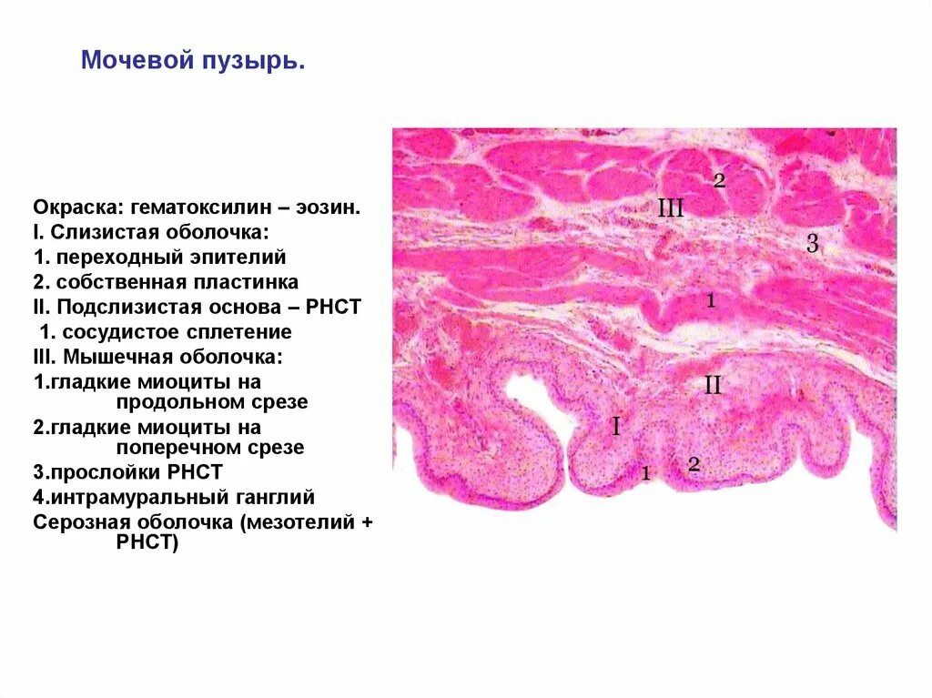 Срез стенки мочевого пузыря гистология препарат. Мочевой пузырь (переходный эпителий, гладкая мышечная ткань).. Переходный эпителий мочевого пузыря окраска гематоксилин-эозином. Препарат мочевой пузырь окраска гематоксилин эозин.