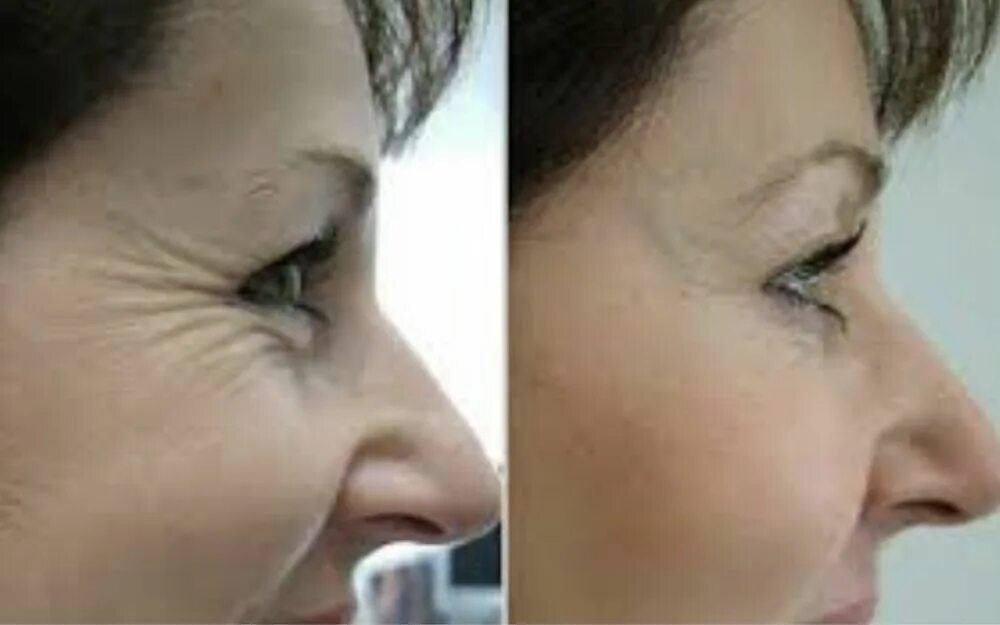 She was detained by border control because of the extremely effective anti-aging