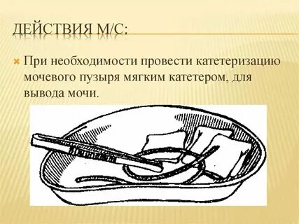 Катетер фолея алгоритм мужчине