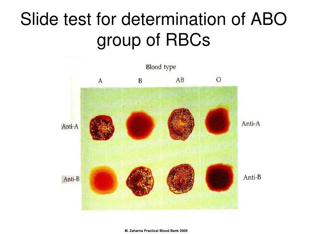 Blood Group Test. Blood Test название. Determination of Blood Groups. Blood Type determination.