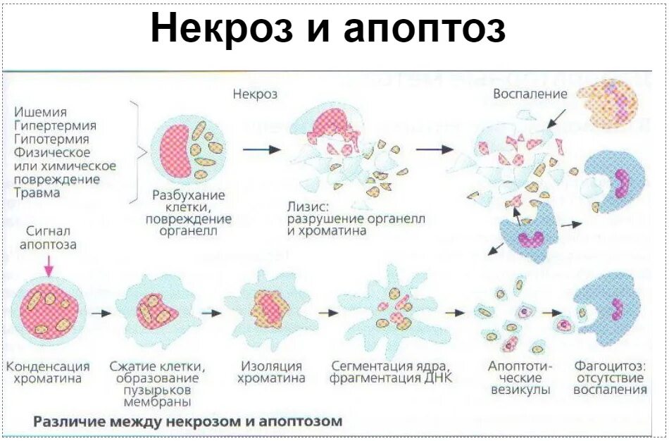 Механизмы гибели клеток апоптоз и некроз. Схема стадий некроза и апоптоза. Апоптоз механизм патофизиология. Гибель клетки апоптоз и некроз схема. Необратимые изменения клетки