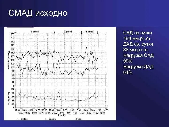 Запись смад. Запись смад