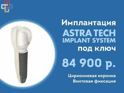 Astra имплант отзывы