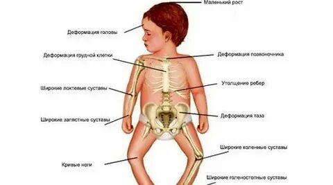 Костная система у детей