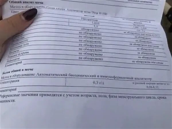 3 г/л. Белок в моче 0,55. Белок 0 066. Белок в моче 0 033 у женщины. Белок в моче при беременности 1.