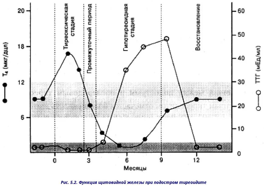 Стадии подострого тиреоидита. Подострый тиреоидит фазы. Подострый лимфоцитарный тиреоидит. Подострый тиреоидит стадии. Лимфоцитарный тиреоидит