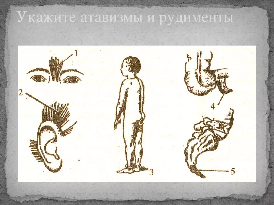 Атавизмы и рудименты человека примеры. Рудимениты и атави зщмы. рудименты и атавизмы примеры. примеры рудиментов и атавизмов у человека.