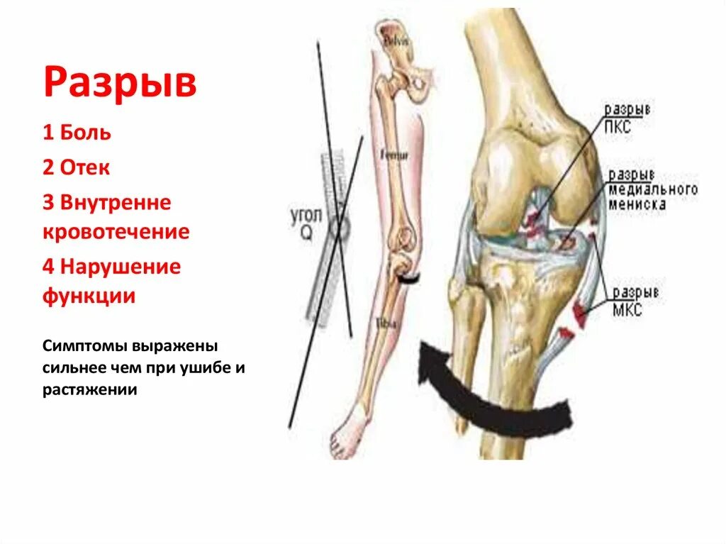 Механические повреждения травмы. Закрытые механические травмы. Механические повреждения током.