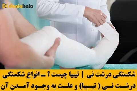 К чему снится сломанная нога