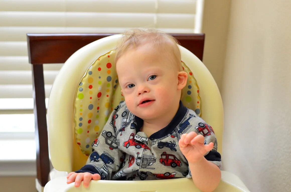baby with downs syndrome - Wyoming Department of Health