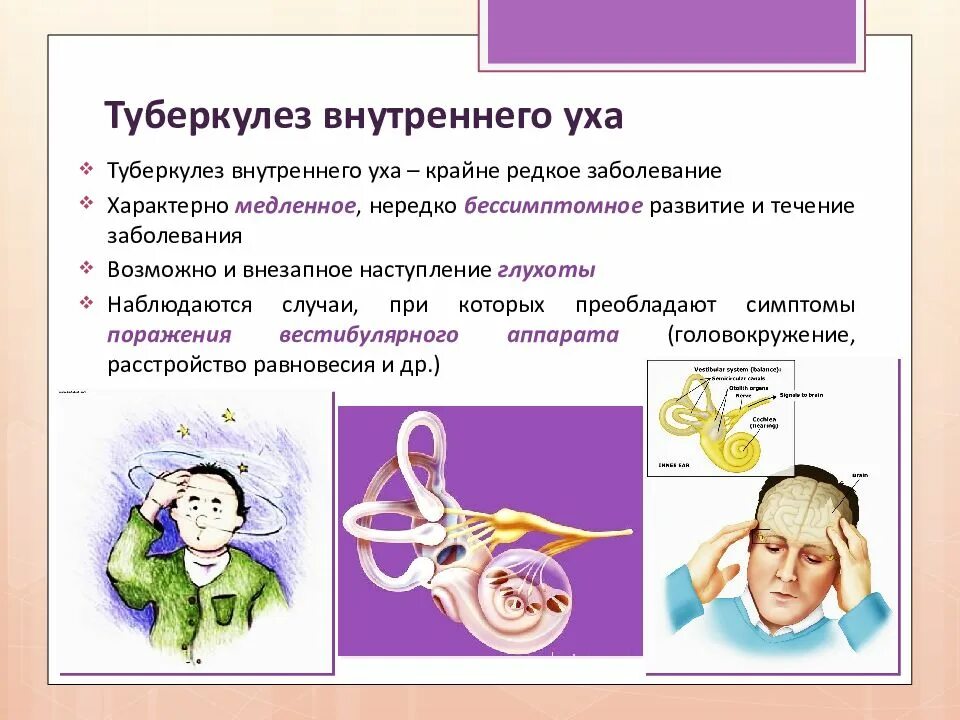 Заболевания связанные с ушами. Туберкулез внутреннего уха. туберкулез уха презентация. заболевания среднего и внутреннего уха. заболевания среднего уха презентация.
