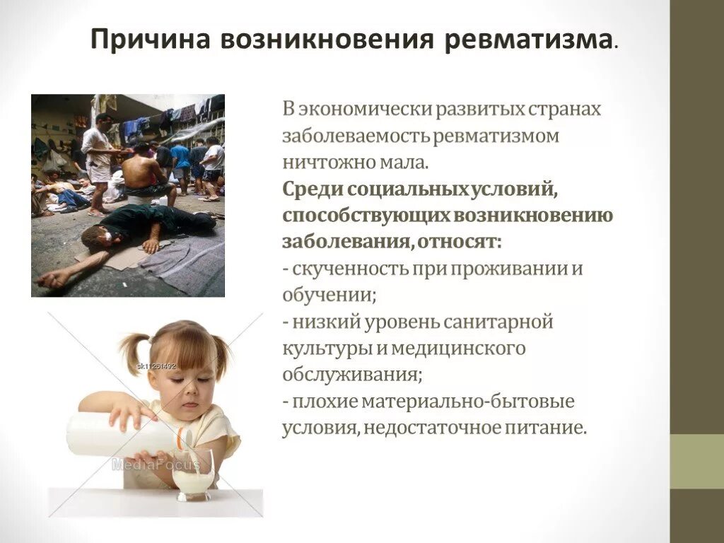 ревматизм причины