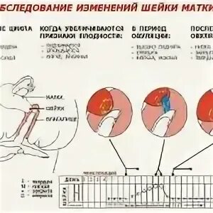 Сокращается матка после месячных