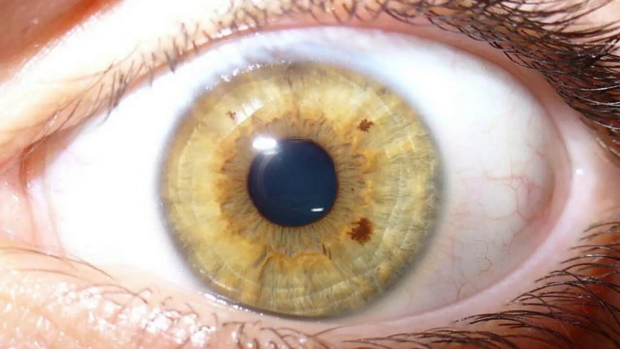 Желто коричневые глаза. Янтарная радужка глаза. Желтые глаза. Желтая радужка глаза. Какого цвета радужка