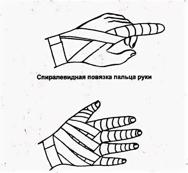 Повязка на руку схема. Спиральная повязка на палец. Наложить повязку на палец. Наложение повязки на палец руки. Виды повязок на палец.
