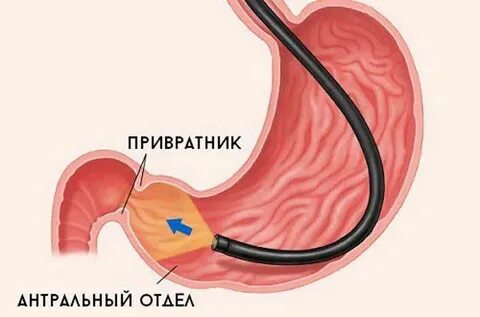 Кардия и привратник что это