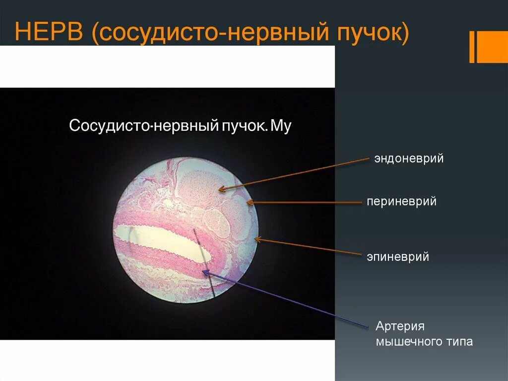Нервный пучок гистология. Сосудисто нервный пучок. сосудитонервный пучок гистология. сосудистонервыный пучок гистология. сосудисто нервный пучок препарат.