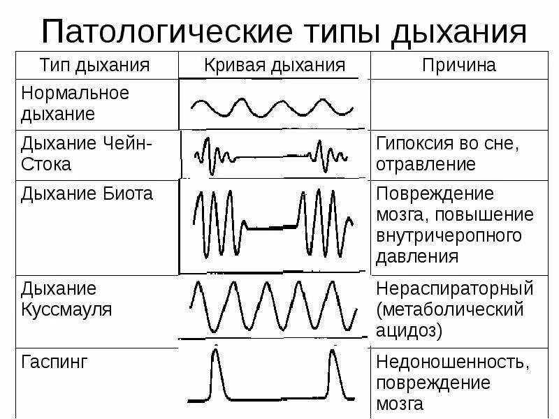 Легочный тип дыхания характерен. Типы дыхания Куссмауля Чейна Стокса Биота. Типы дыхания Биота чейн Стокса патологические Куссмауля. Патологические типы дыхания Грокка. Гаспинг дыхание патогенез.