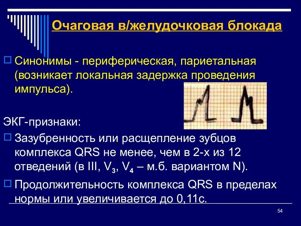 Что значит на экг нарушение внутрижелудочковой проводимости. Очаговая внутрижелудочковая блокада на экг. желудочковая блокада на экг. признаки внутрижелудочковой блокады на экг. локальная внутрижелудочковая блокада на экг.