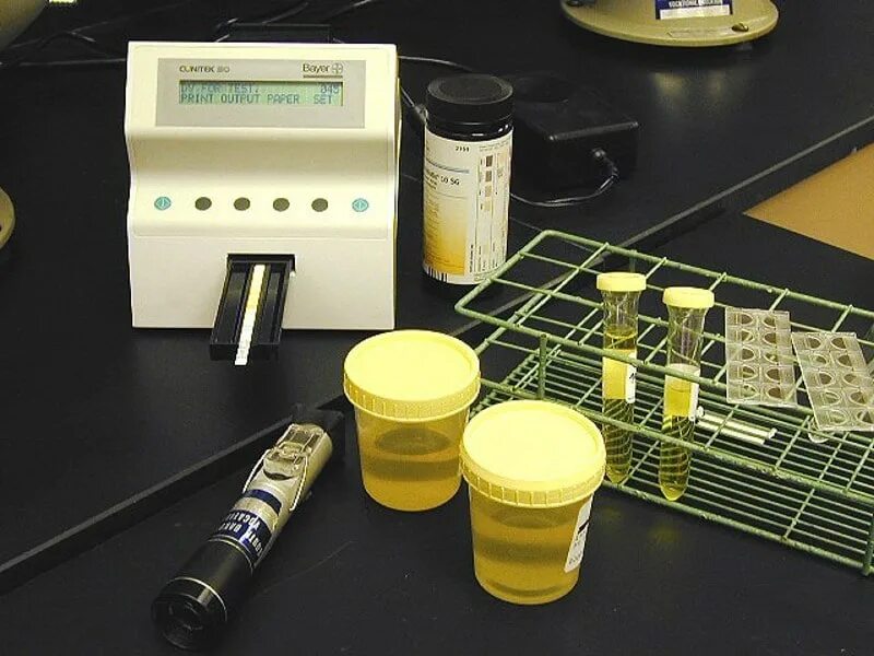 биологическая моча. баночка с мочой. биологические растворы. сбор мочи на пробу реберга. контейнер для мочи по нечипоренко.