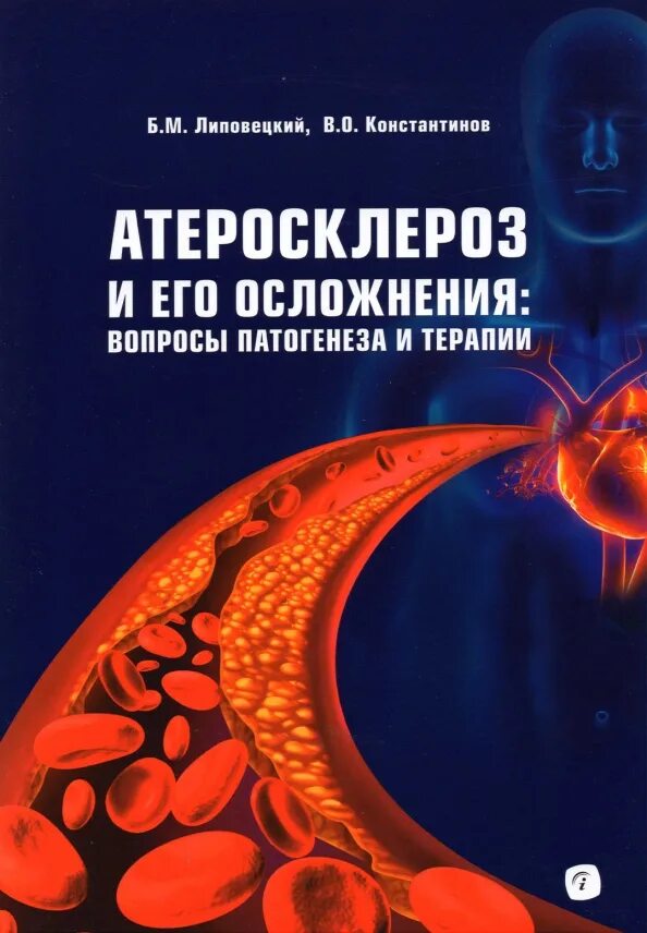 Москва лечение атеросклероза