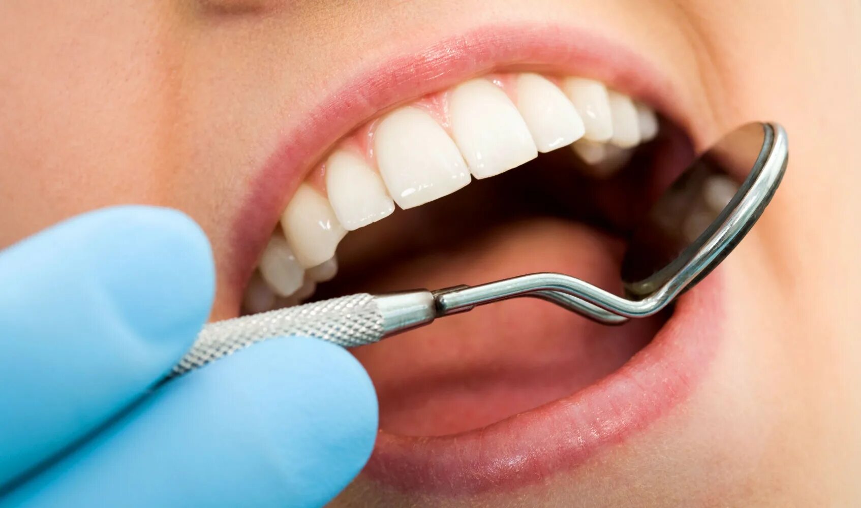 Терапия стоматология. Зубы стоматология.