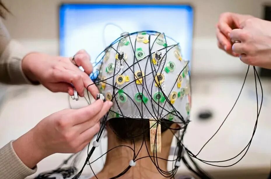 Доктор ээг. Электроэнцефалография (ЭЭГ). EEG elektroentsefalografiya. Нейротех ЭЭГ. Электроэнцефалографическое исследование (ЭЭГ.