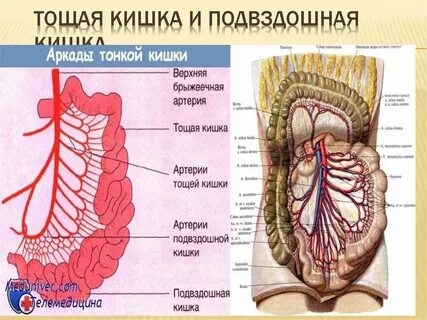 Левая подвздошная кишка
