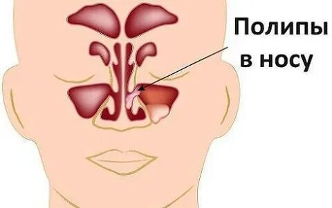 Ночью не дышит нос
