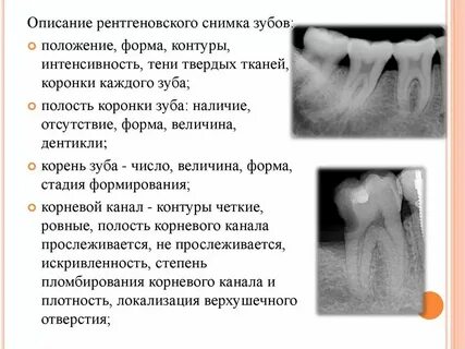 Лагистремия описание и фото