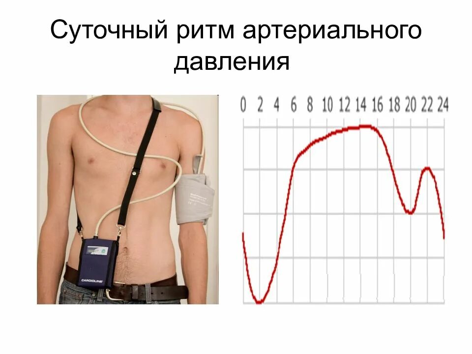 Холтер измеряющий давление