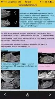 Когда по узи можно узнать пол ребенка