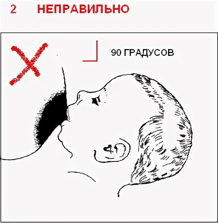 Как правильно прикладывать к груди. Правильное прикладывание к груди. Прикладывание ребенка к груди. Неправильное прикладывание.