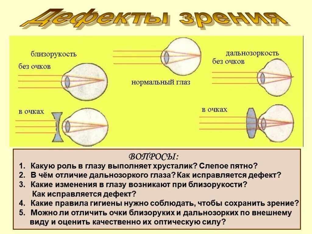 Дальнозорким людям необходимо использовать очки так как