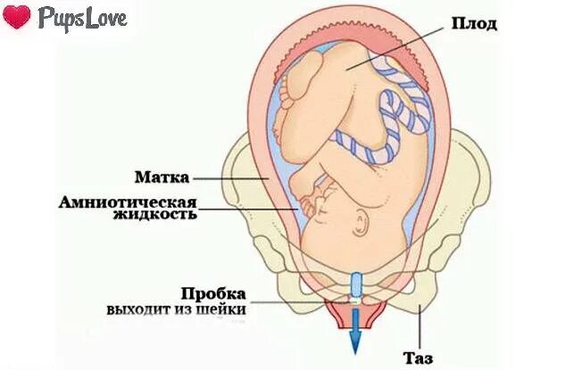 Слизистая пробка при беременности. Что такое отошла пробка у беременных. Слизистая пробка перед родами. Отходит пробка перед родами. 40 неделя беременности нет схваток