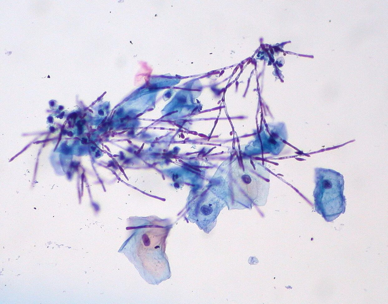 Грибы кандида лептотрикс. Лептотрикс микроскопия. Грибы кандида микроскопия. Мазок кандида микроскопия. Мицелий грибов у женщин