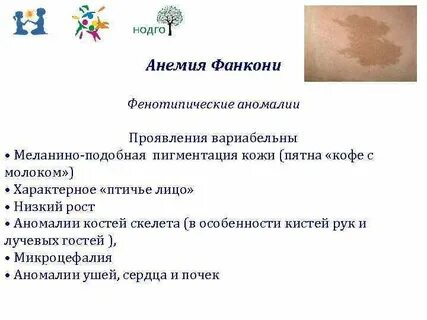 Анемия пятна